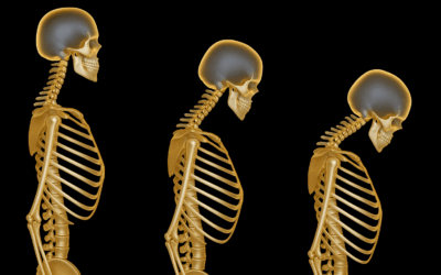 Strong Bones, Sharp Mind: The Important Relationship Between Your Brain, Your Bones, and Your Nutrition